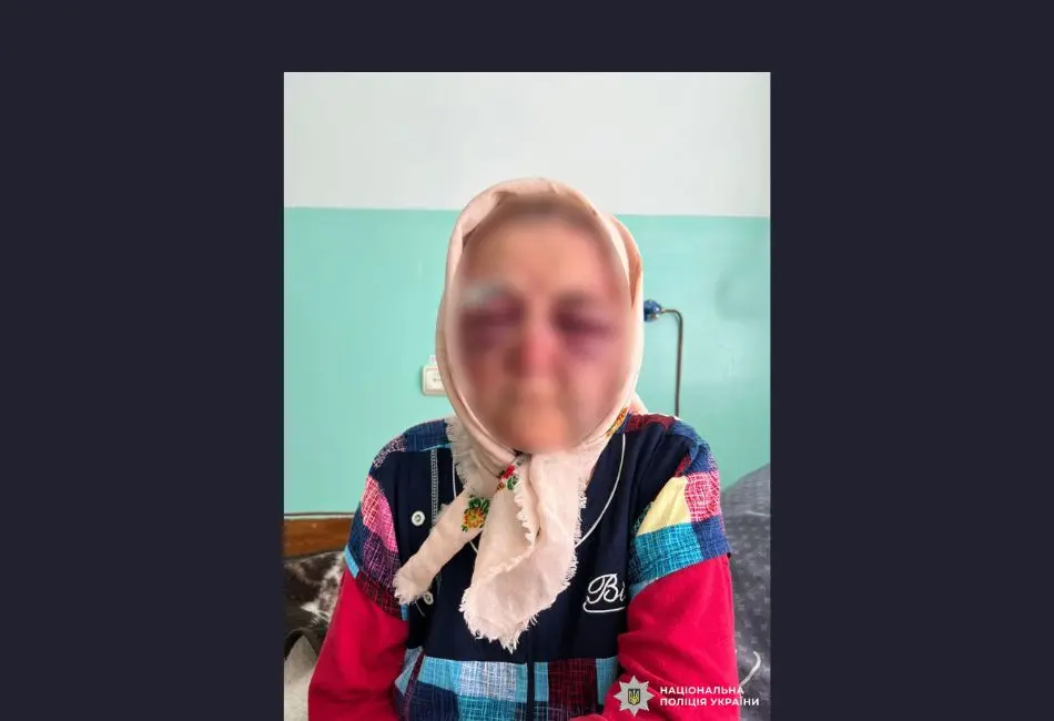 У Жмеринському районі чоловік побив пенсіонерку та вкрав 18 тис. грн