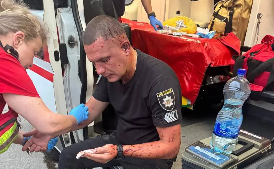 Троє столичних поліцейських, які постраждали під час ракетного удару рф по Києву 31 липня, досі перебувають у лікарні