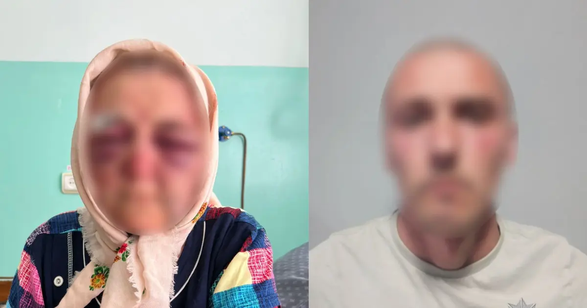 На Вінниччині раніше судимий чоловік побив і пограбував 87-річну сусідку